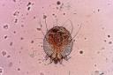A scabies mite, magnified 100 times