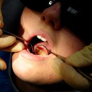 The number of NHS dentists is down compared to 2019