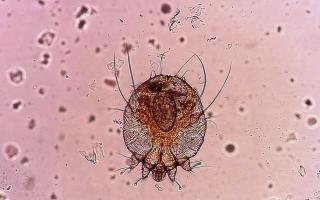 A scabies mite, magnified 100 times